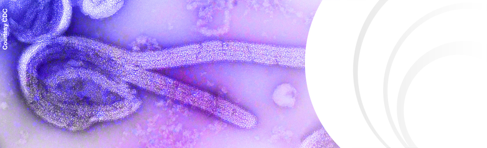 Electron microscope image of Ebola virus