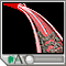 Balloon angioplasty