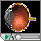 Diabetes mellitus - retinal conditions