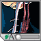 Accidente cerebrovascular