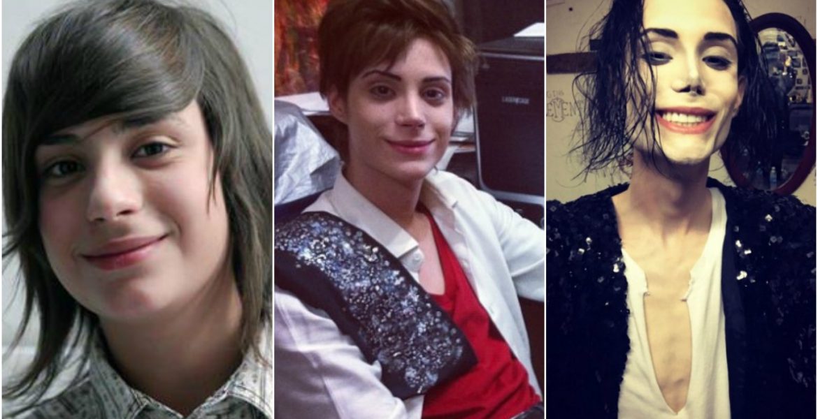 hijo de petinatto antes y despues