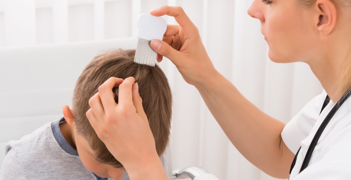 como eliminar los piojos para siempre