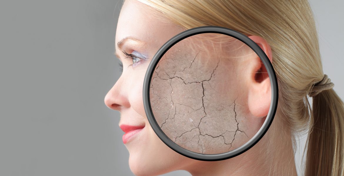 Qué significa cuando tienes cara seca y tienes piel sensible​