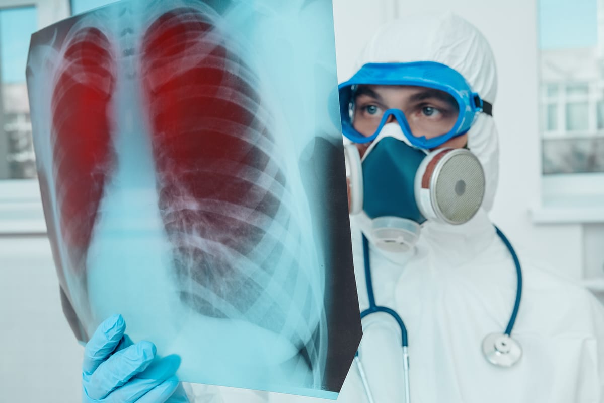 Mayores y cuarentena: por qué la edad no es lo más importante 19 Mayores y cuarentena: por qué la edad no es lo más importante 15