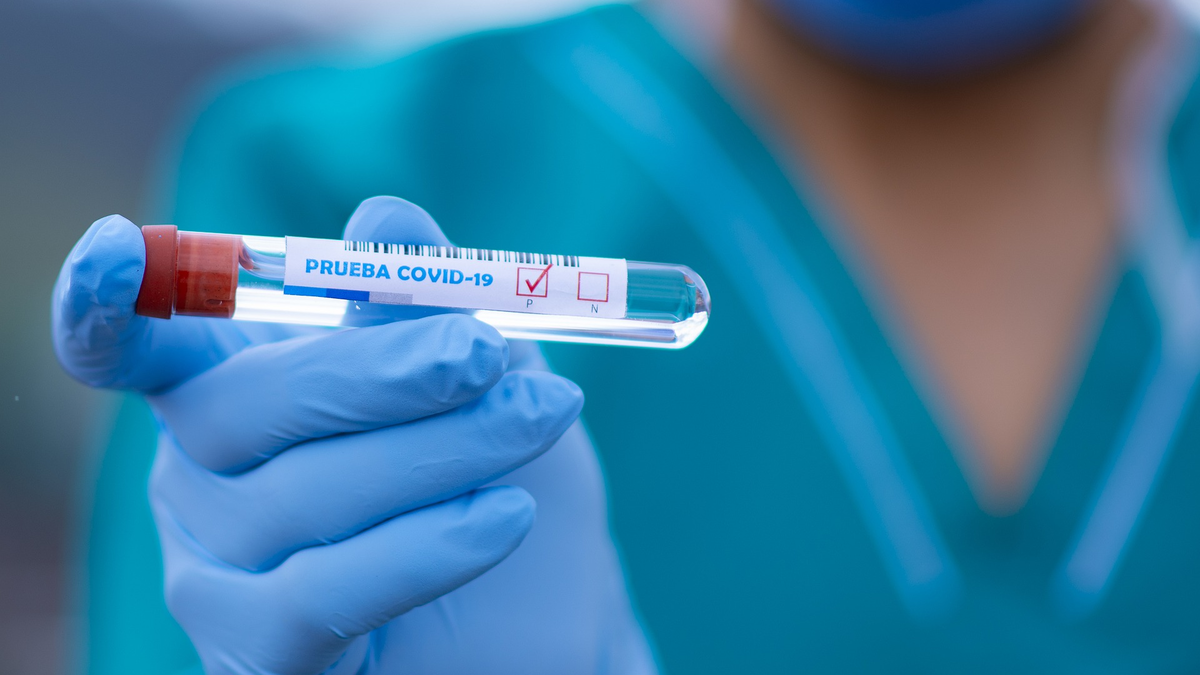 test coronavirus
