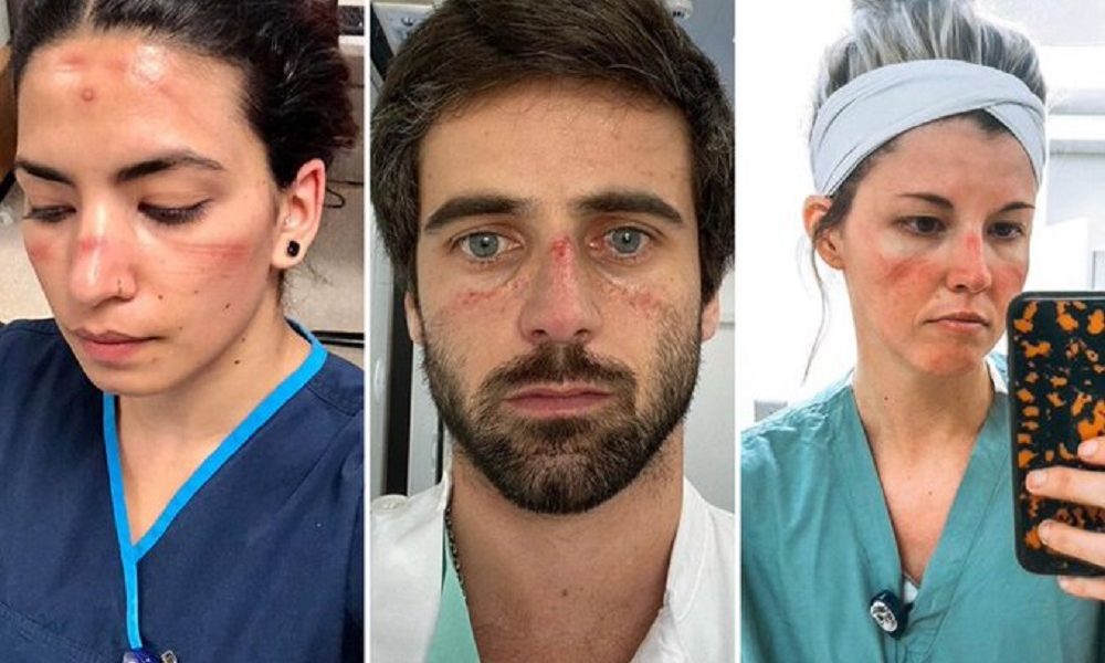 Relajados: una confusión conceptual inadmisible y revulsiva 3