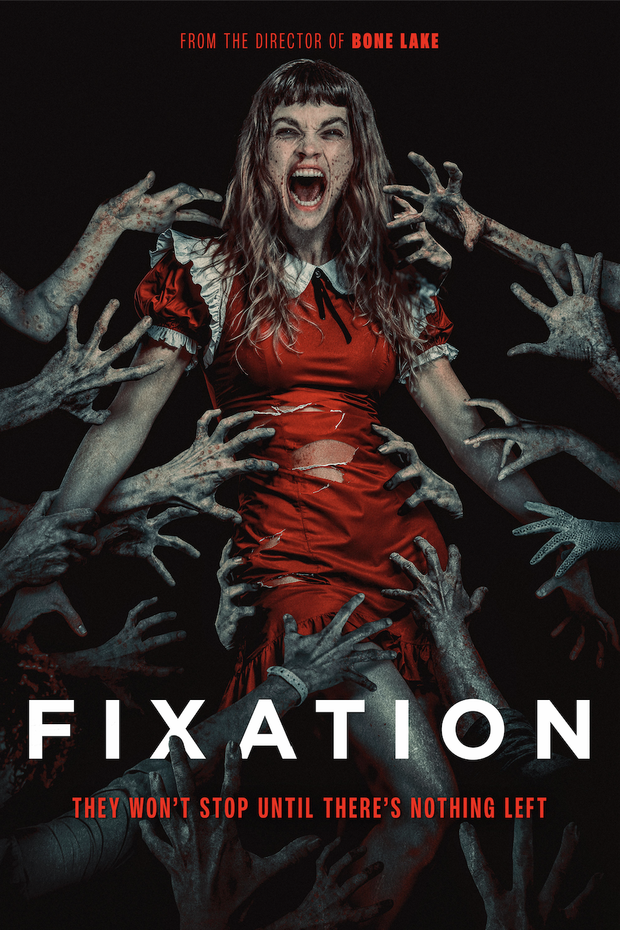 FIXATION
