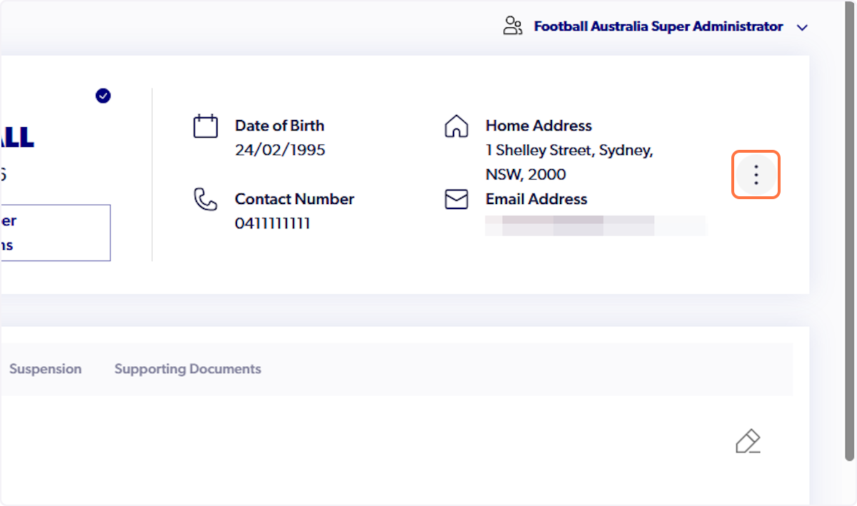 Click on three dots on the right hand side of profile