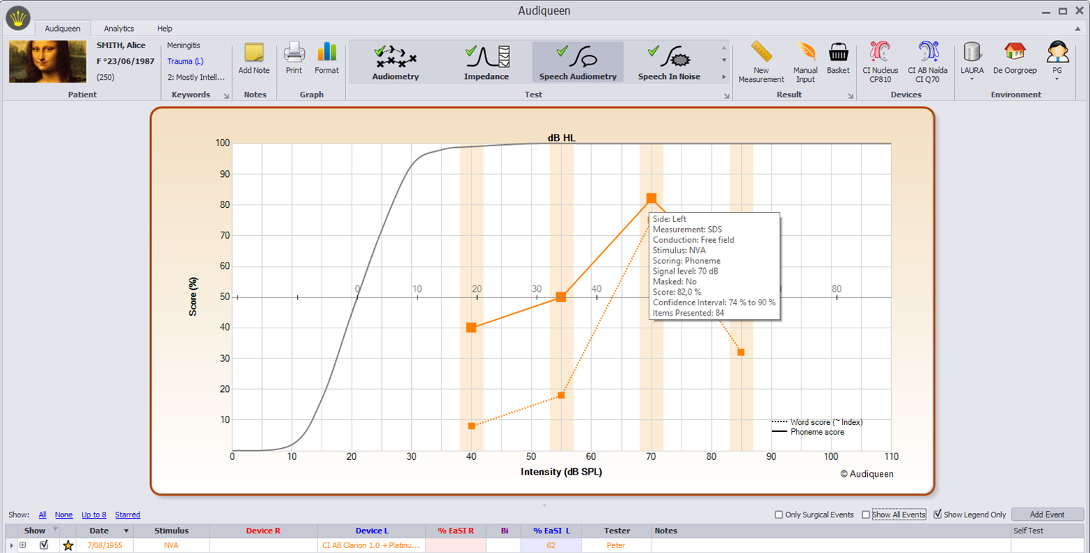 Typical image of the speech audiometry. The speech audiogram shows word and phoneme scores at different presentation levels (40, 55, 70, 85 dB SPL).  The second horizontal axis represents the dB HL scale, with 0% at the intercept with the normal curve.  Hovering with the mouse over a specific point reveals all raw details of that outcome.