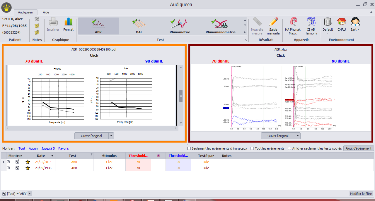 The ABR results are summarized in the list showing the stimulus used and the indices. Audiqueen displays a preview of the report. The original report can be readily opened with the proper software (e.g. Acrobat Reader for pdf reports).