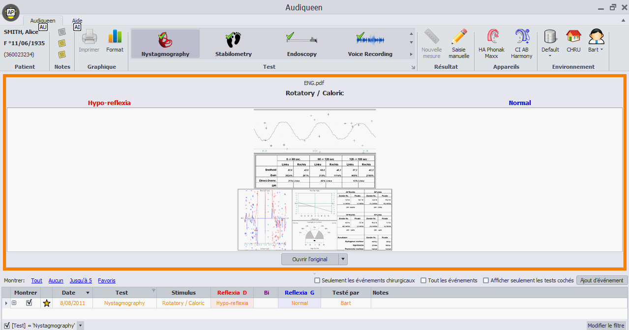 The ENG/VNG results are summarized in the list showing the stimulus used and the indices. Audiqueen displays a preview of the report. The original report can be readily opened with the proper software (e.g. Acrobat Reader for pdf reports).