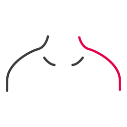 (C) Sloping -1.5