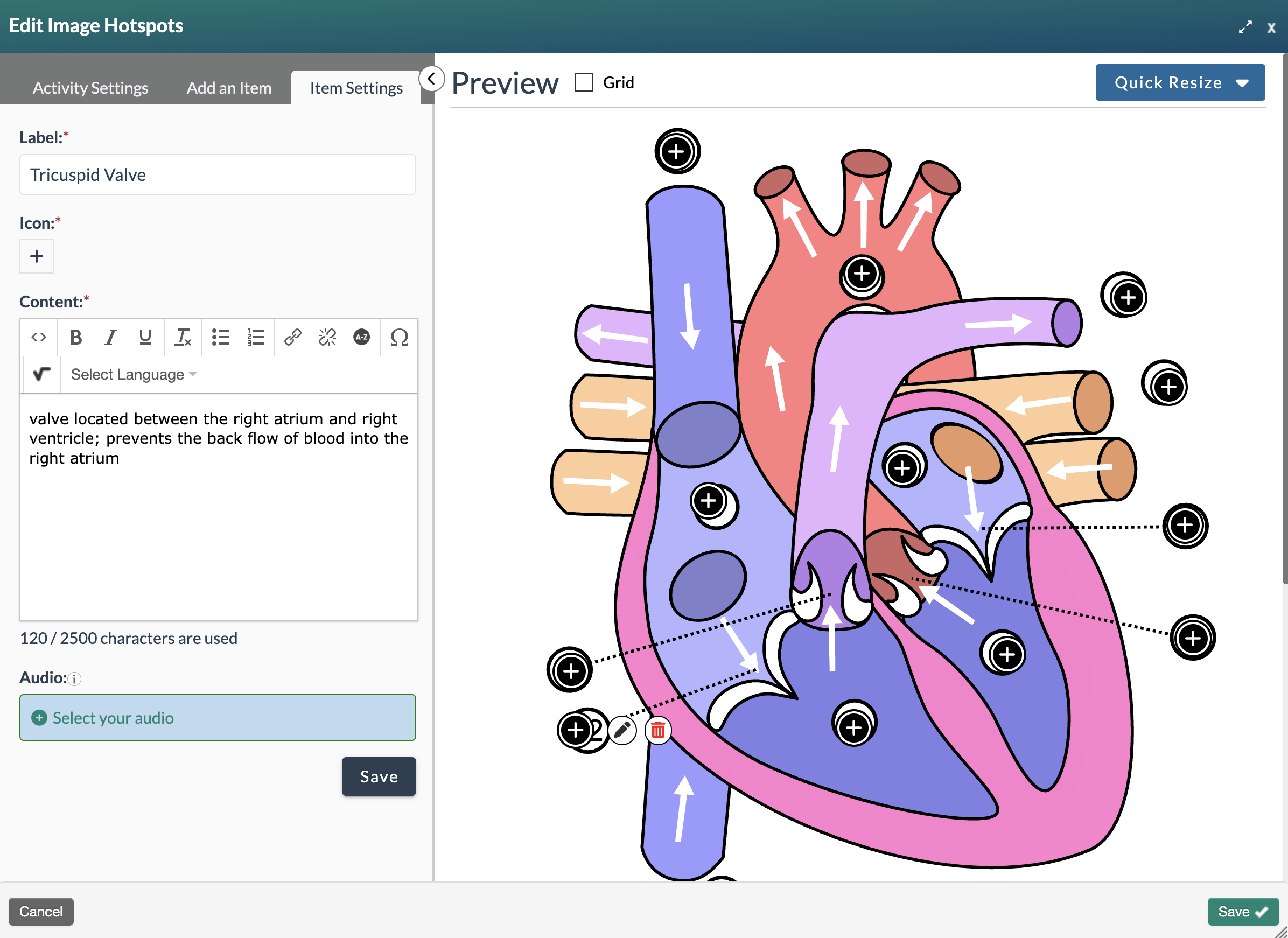 screenshot showing the interactive matching editing modal with the add item tab selected and adding an audio item.