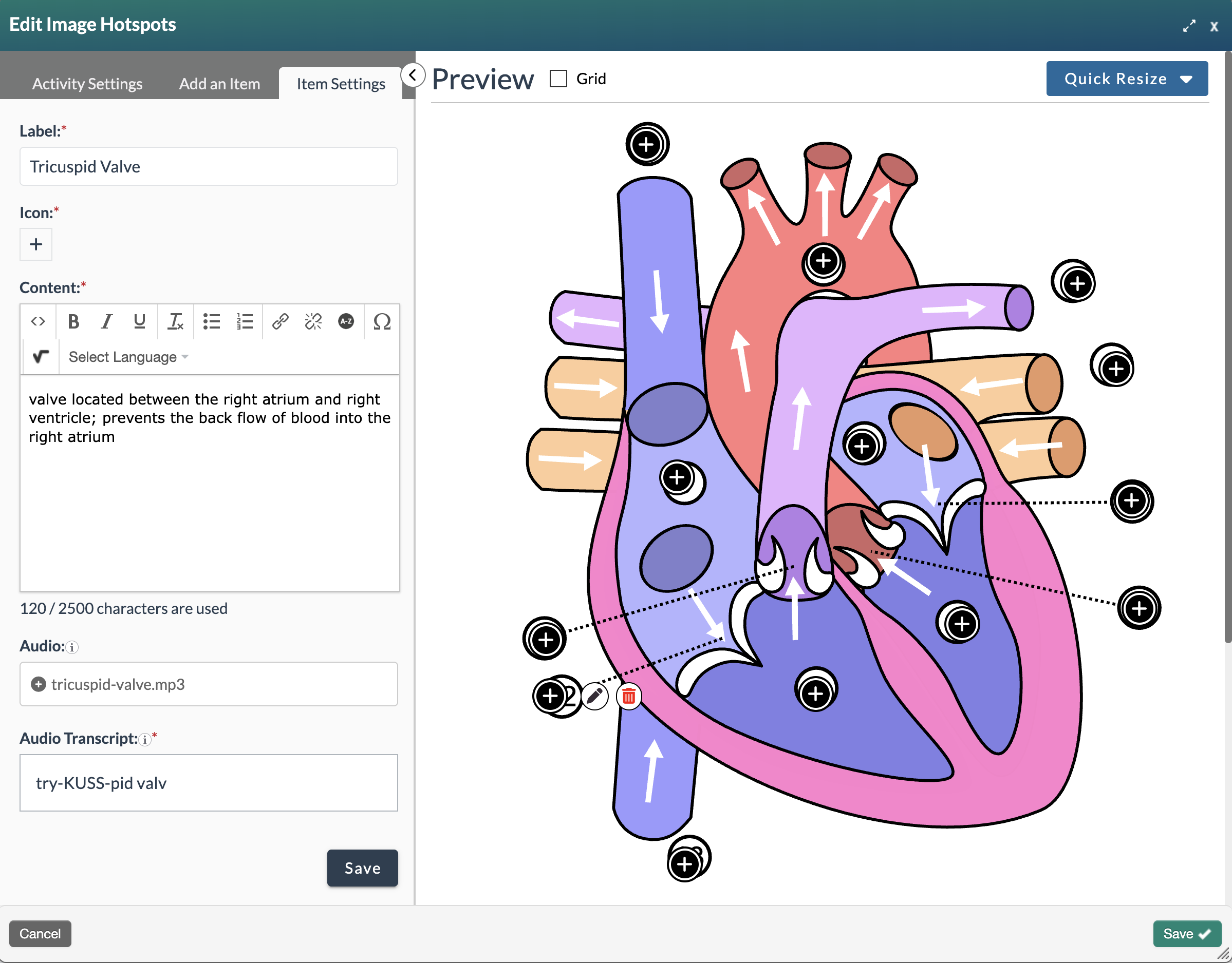 screenshot showing the interactive matching editing modal with the add item tab selected and adding an audio item with the audio transcript and answer fields filled in