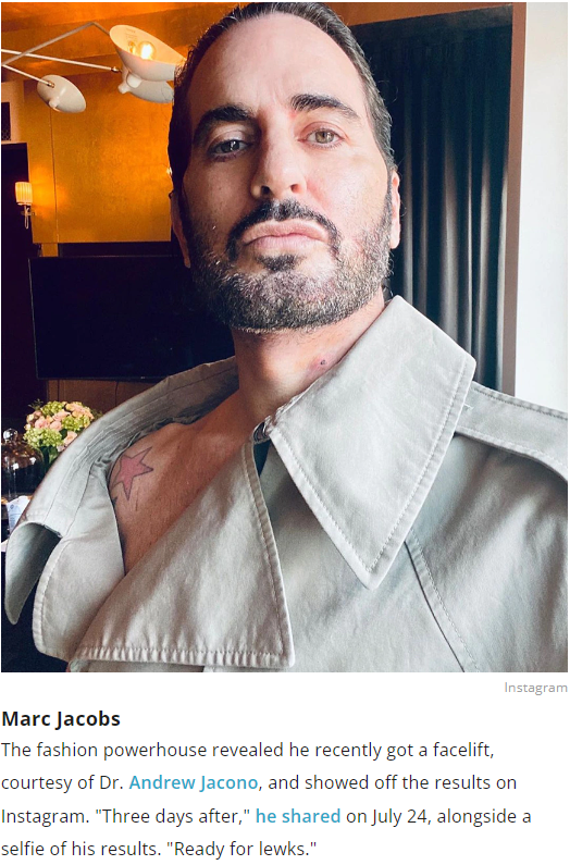 Marc Jacobs 
 shows off his Facelift Results