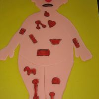 Operation Game Board Game This is my take on a get well soon cake!