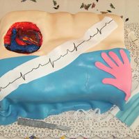 Heart SIL just graduated Cardiovascular Technician, my brother found cake idea and we surprised her. It was lots of fun, idea came from brider