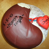 Kidney Celebration for a year anniversary of a kidney transplant. "Cheryl" is the donor.