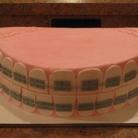 Braces Oval pan cut in half and stacked iced in buttercream with fondant accents. Thanks to sugarlaced for posting hers and it was my inspiration...