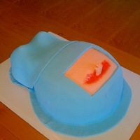 C-Section Cake A Cake for a OBGYN Office