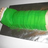 Broken Leg Cast Cake This was a birthday cake. The birthday guyy was actually wearing this green cast because of a broken leg. That's what I call good...