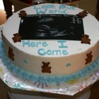 Baby Shower With Sonogram On Top This is an actual sonogram, not edible. All buttercream accents.