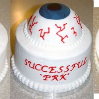 Eyeball Had a friend who had PRK (similar to LASIK). Made the cake to celebrate not having to wear glasses anymore! Used half of the sportsball pan...