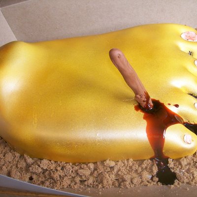 Foot With A Stick In It