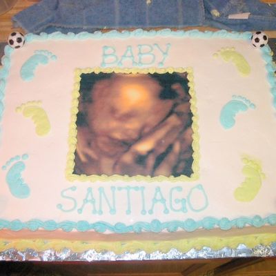 Sonogram Cake