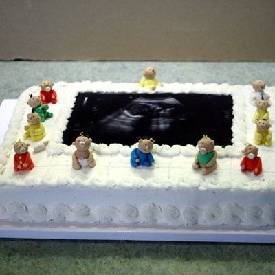 Ultrasound Shower Cake