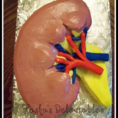 3D Kidney