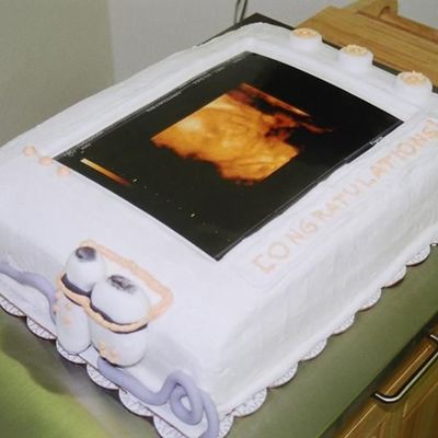 Sonogram Screen For Baby Shower