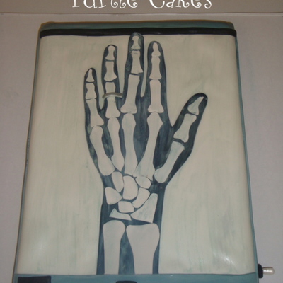 X-Ray