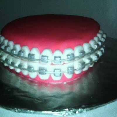 Braces Cake