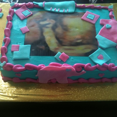 Ultrasound/sonogram Cake