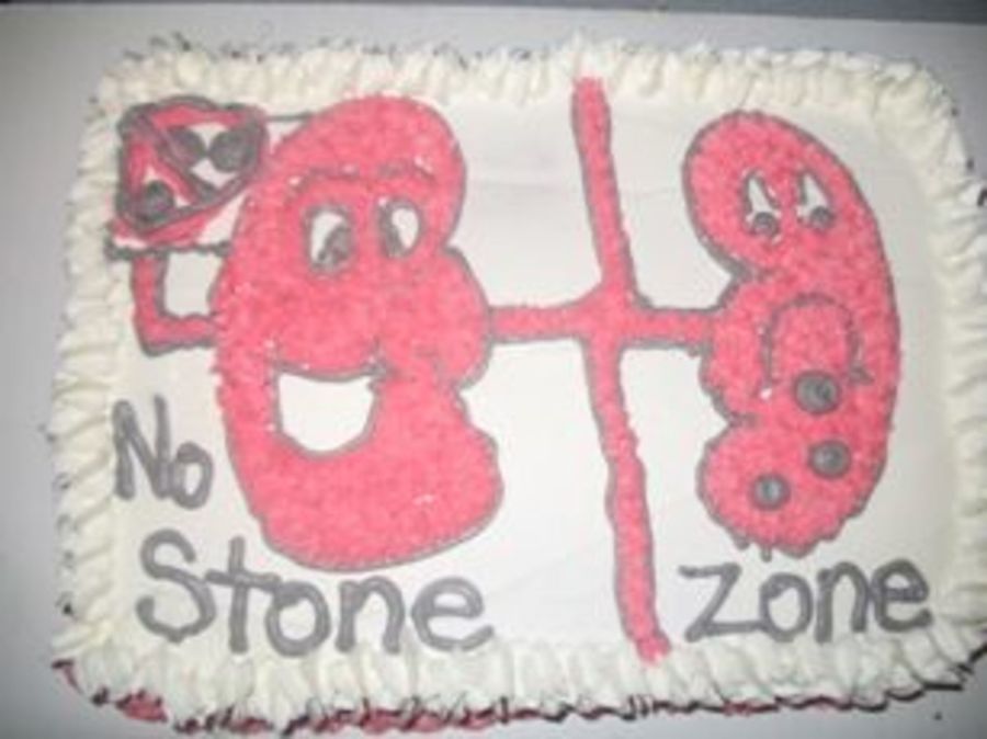 Kidney Stone Cake