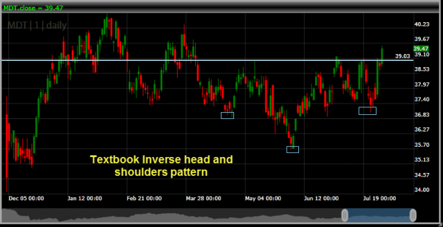 MDT-Chart of the Day