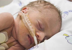 photo grand-premature