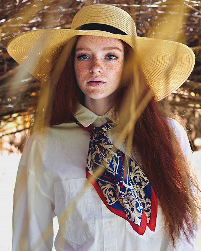 A freckled red-haired woman wearing a hat and scarf in a soft, sunlit outdoor setting.