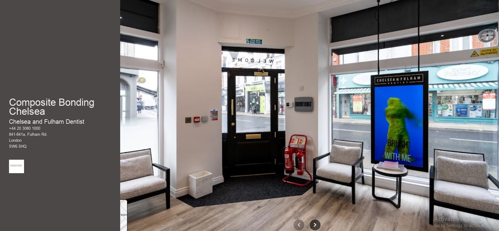 Composite Bonding Chelsea