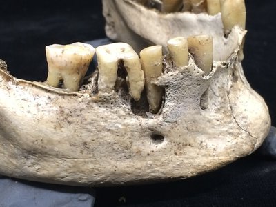 Teeth