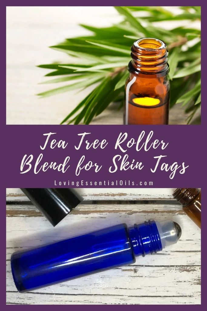 Unknown Facts About Essential Oil Roller Blends