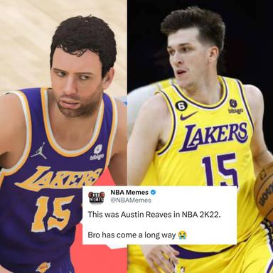 They had bro looking like a homeless manπ