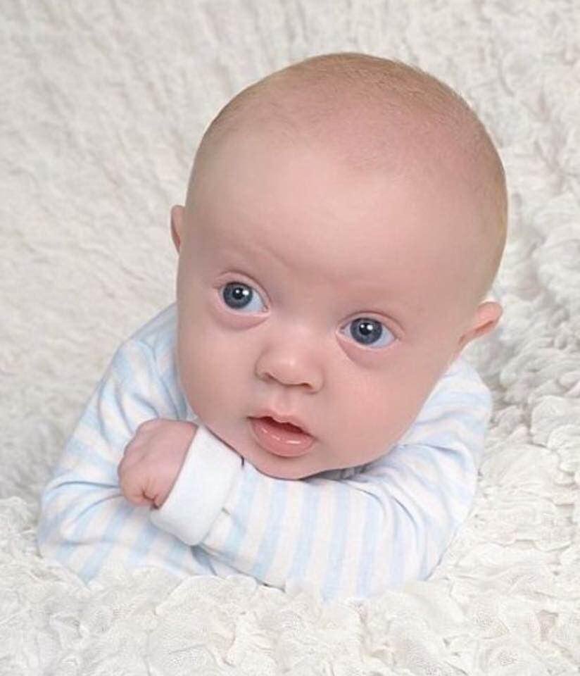The face of an angel !!!!! One year ago today God gave us this angel who has enriched and blessed our lives just by being in them. You are going to go far little man, you have incredible strength and character. What you