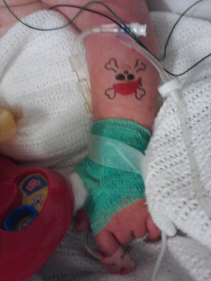 My kid came out of surgery with a green cast on his wrist and a tattoo%21 What kind of hospital is this%3F%21 %3A%29