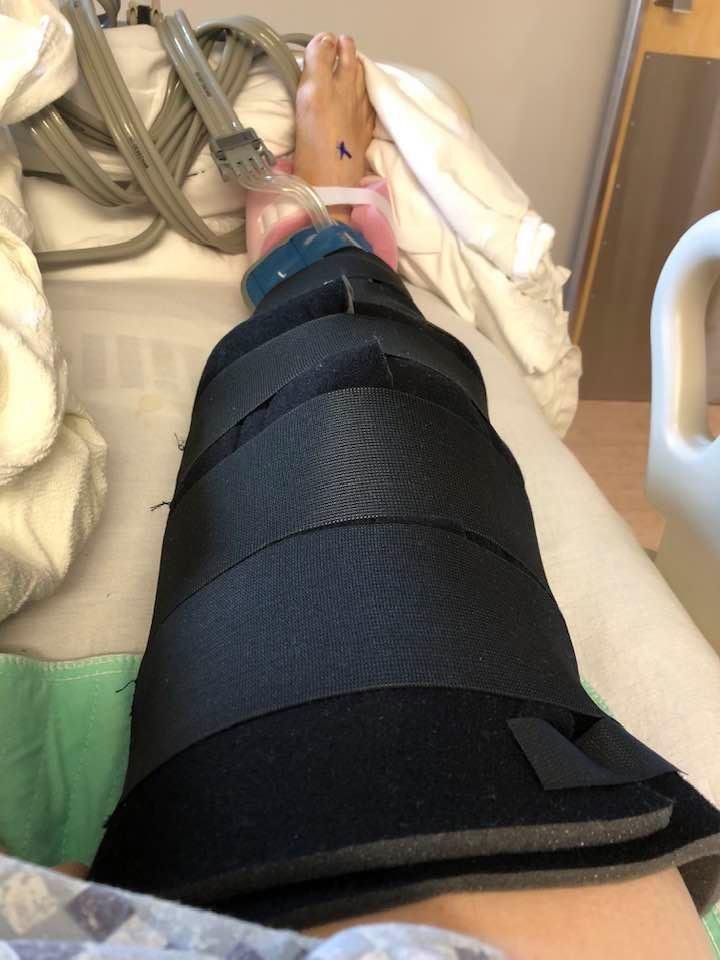 Had a total knee replacement surgery this morning at the Lebanon VA Hospital and the nurses and Doctors and hospital staff are the greatest. I had my left knee replaced this past May and the pain is out of this world painfu