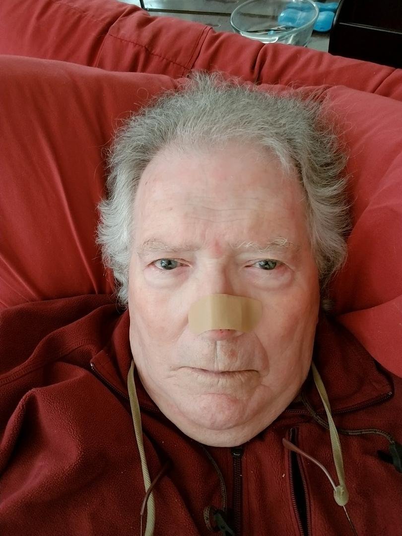 I left that part of my nose at the VA hospital