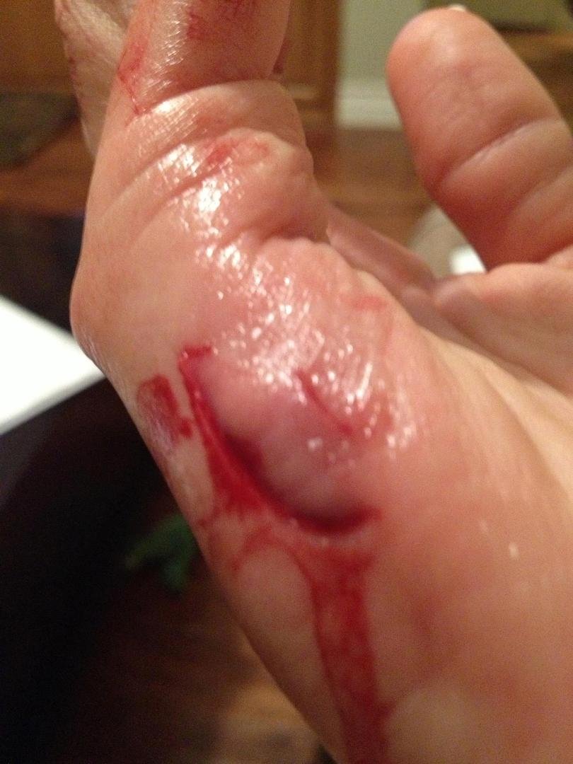 OUCH!