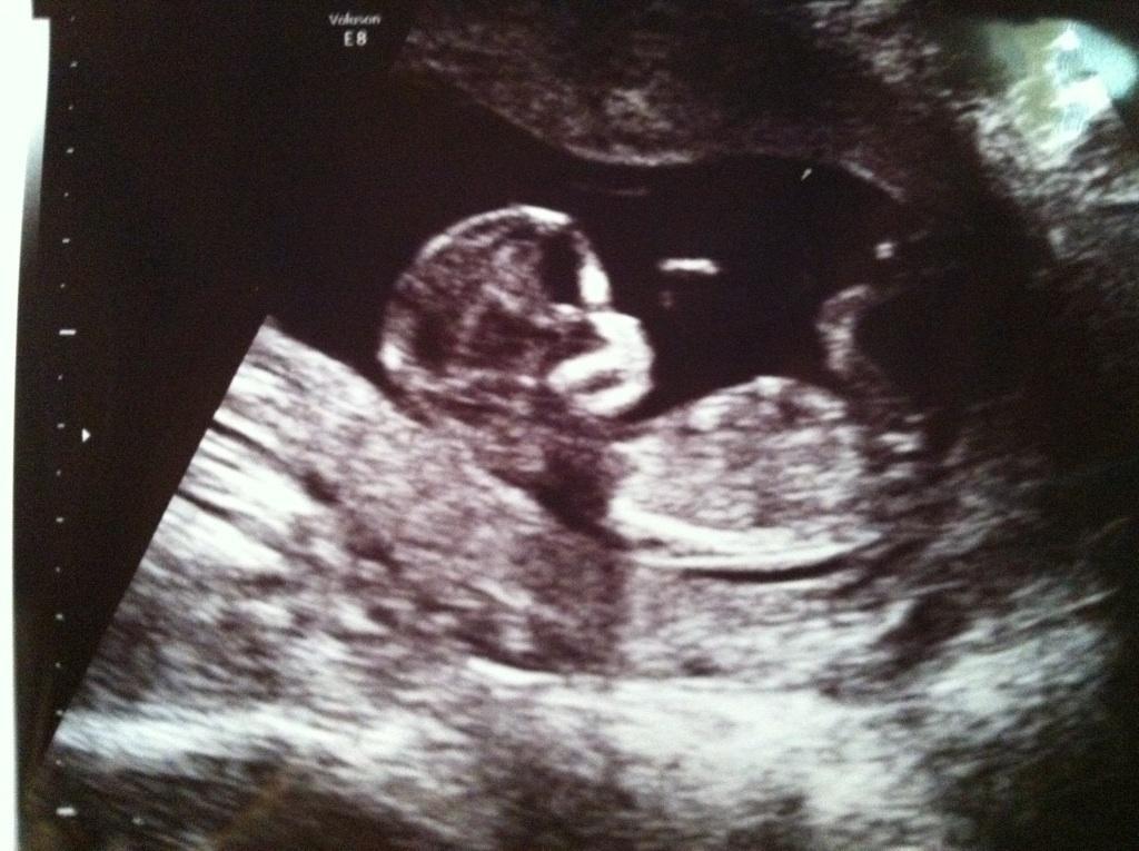 Here's the first pic of grandbaby #10!