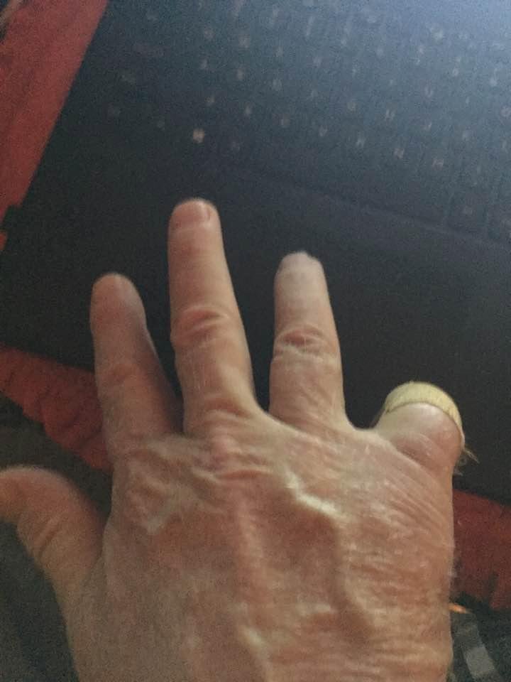 Well at least I still have my bowling fingers. I might drill an extra hole in my ball. LOL